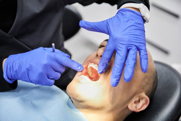 Best Broken or Cracked Tooth Emergency Dentist in Rose Hill, NC